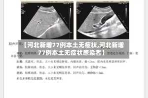 【河北新增77例本土无症状,河北新增77例本土无症状感染者】