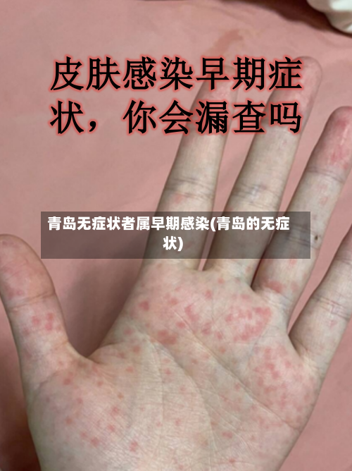 青岛无症状者属早期感染(青岛的无症状)-第2张图片