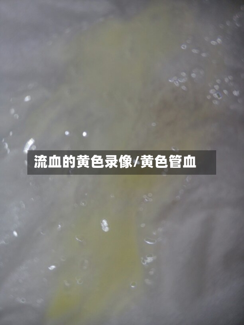 流血的黄色录像/黄色管血-第3张图片