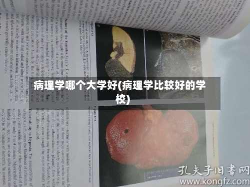病理学哪个大学好(病理学比较好的学校)-第1张图片