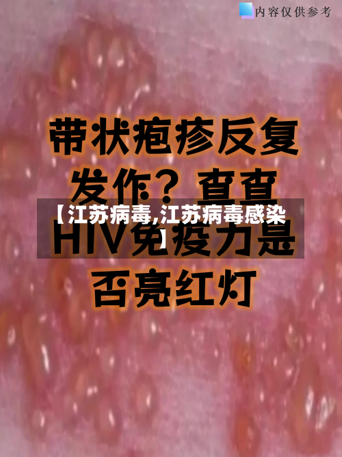 【江苏病毒,江苏病毒感染】-第2张图片