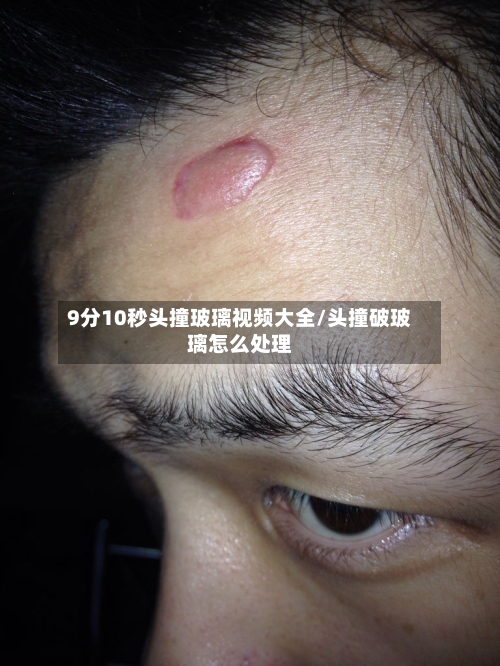 9分10秒头撞玻璃视频大全/头撞破玻璃怎么处理-第1张图片
