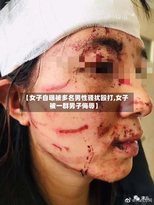 【女子自曝被多名男性骚扰殴打,女子被一群男子侮辱】-第1张图片